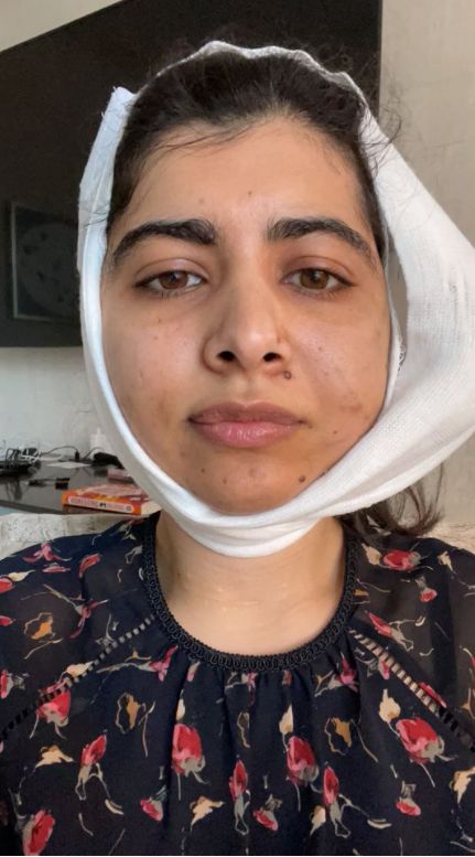 Малала Юсуфзай после операции